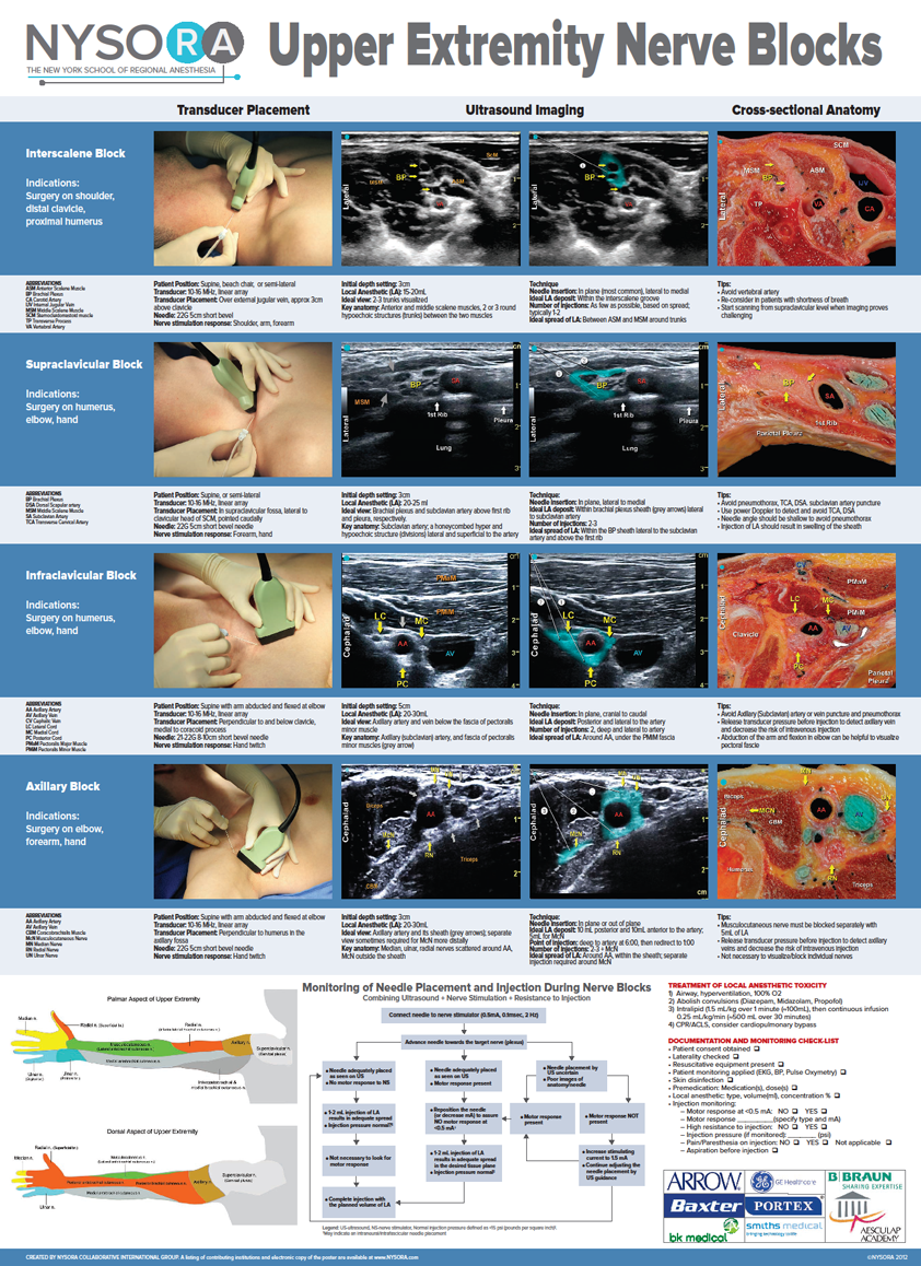 Nysora The New York School Of Regional Anesthesia Nysora Educational Posters 2