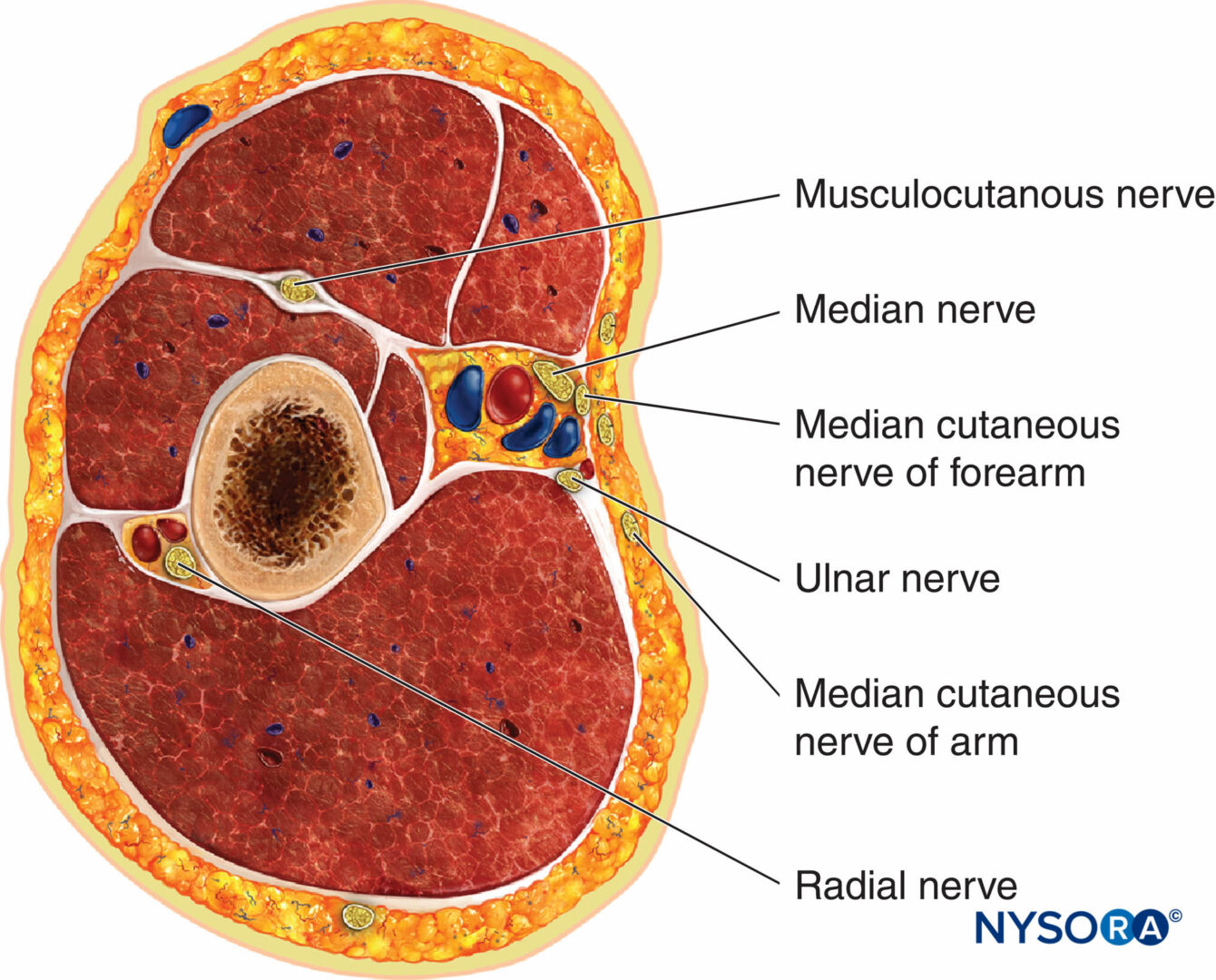 Blockade des axillären Plexus brachialis Orientierungspunkte und