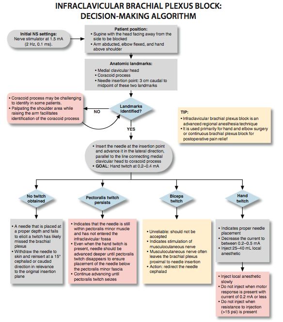 Infraclavicular Brachial Plexus Block - NYSORA The New York School of ...