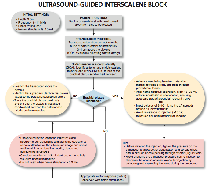 Ultrasound-Guided Interscalene Brachial Plexus Block - NYSORA The New ...