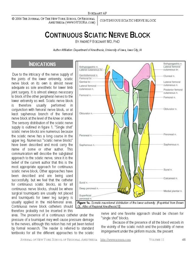 Sciatic Nerve Block Landmarks