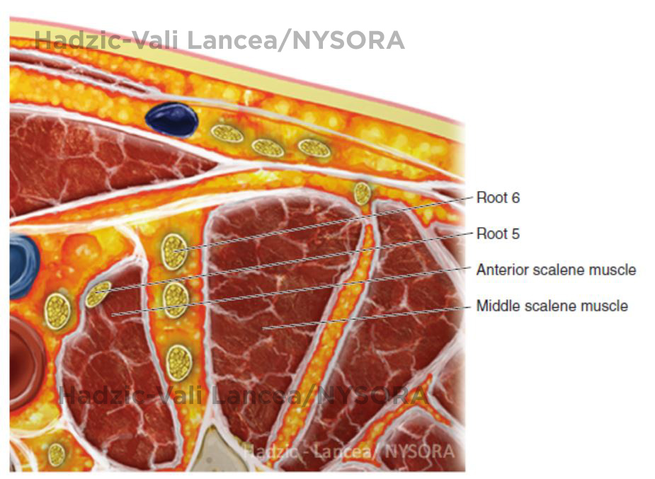 Brachial Plexus Block Anatomy