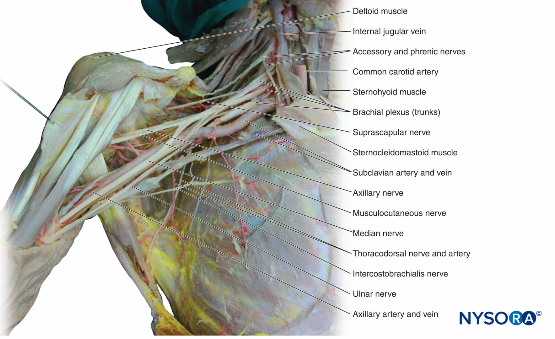 Recurrent median nerve: anatomy, pathway and supply