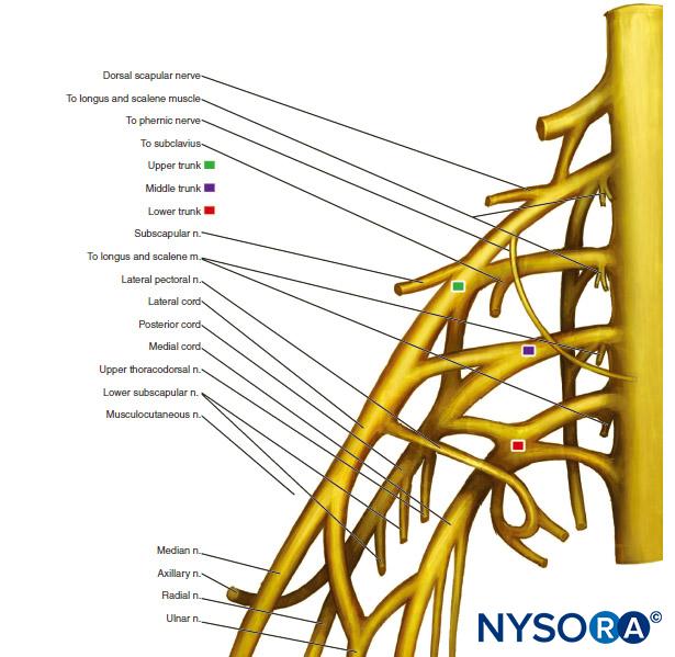 Interscalene Brachial Plexus Block - Landmarks and Nerve Stimulator ...