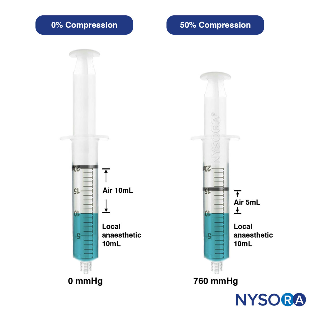 3 Piece Syringe Set Consisting of 1 ml, 2 ml, 5 ml, Includes 3 x 37