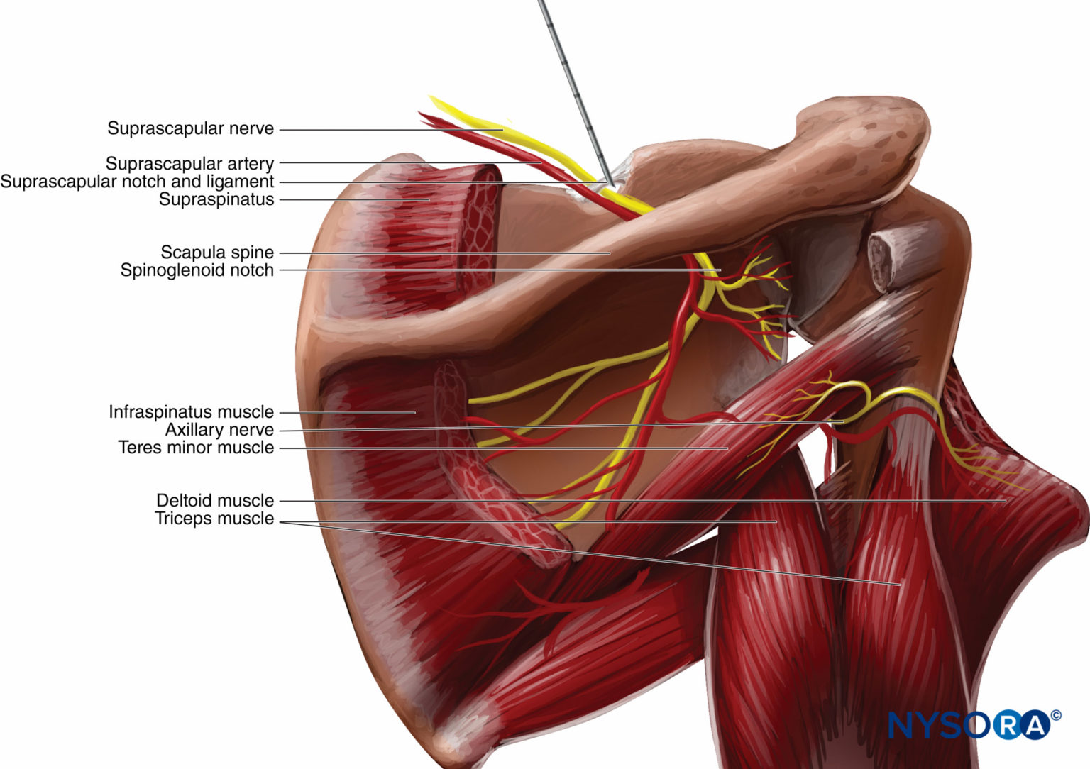 Cutaneous Blocks For The Upper Extremity Landmarks And Nerve Stimulator Technique NYSORA