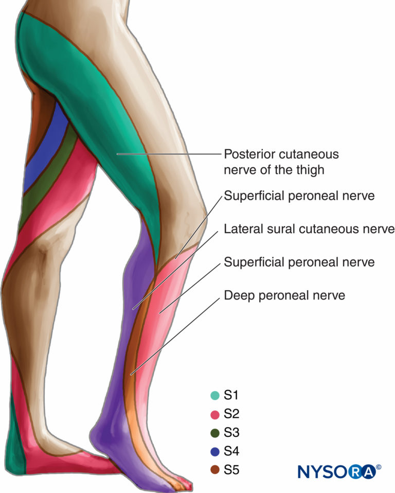 Sciatic Nerve Block - Landmarks and Nerve Stimulator Technique - NYSORA