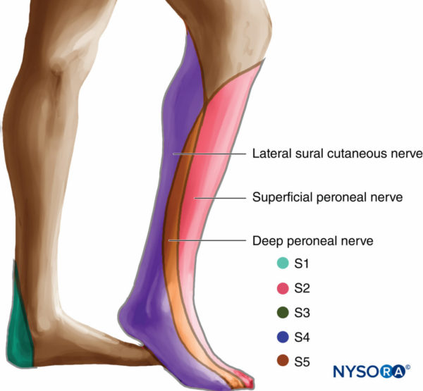 Sciatic Nerve Block - Landmarks and Nerve Stimulator Technique - NYSORA ...