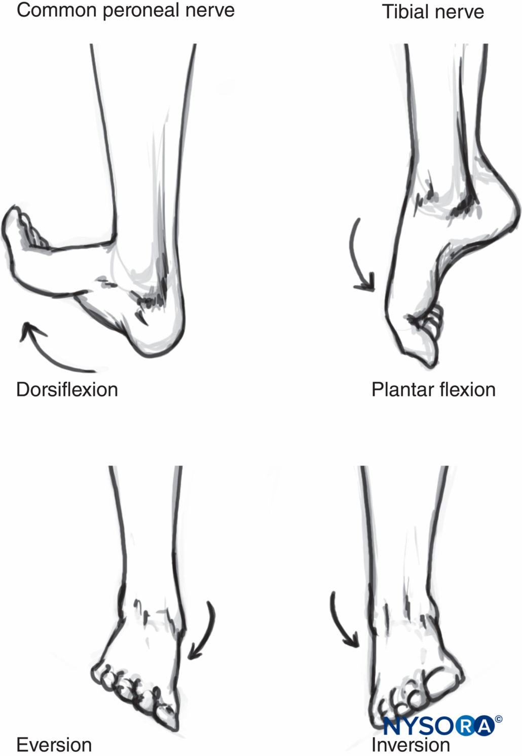 Popliteal Sciatic Nerve Block - Landmarks and Nerve Stimulator ...