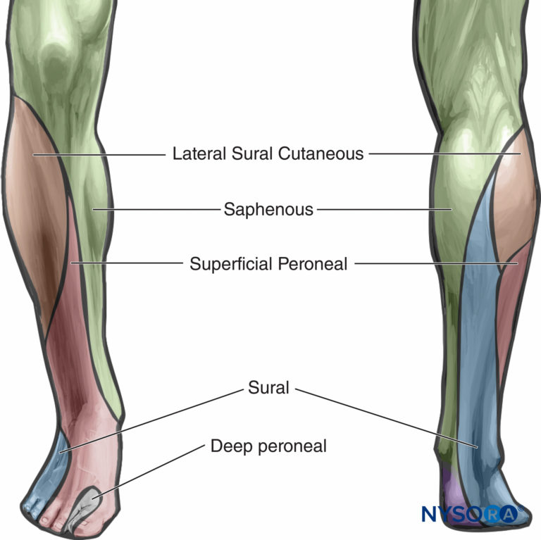 Popliteal Sciatic Nerve Block - Landmarks and Nerve Stimulator ...