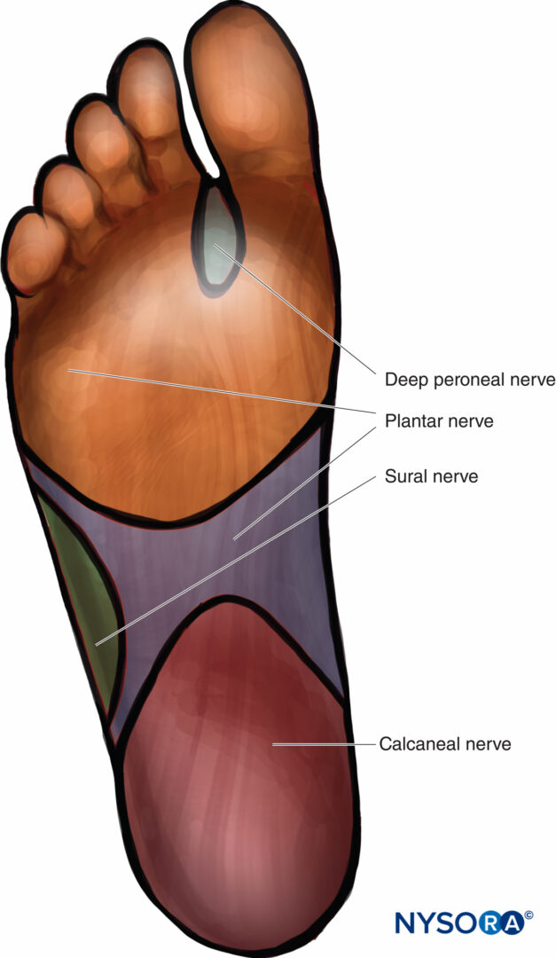 regionalanesthesiasensoryinnervationofthesoleofthefoot