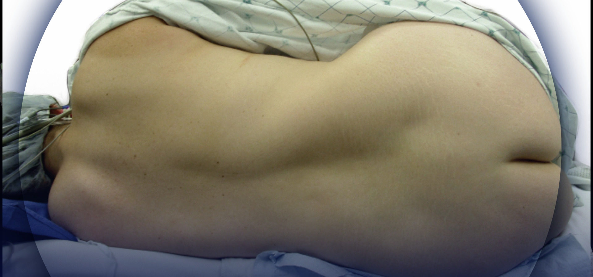 PDF) Alterações na força e área muscular do braço induzidas por 24