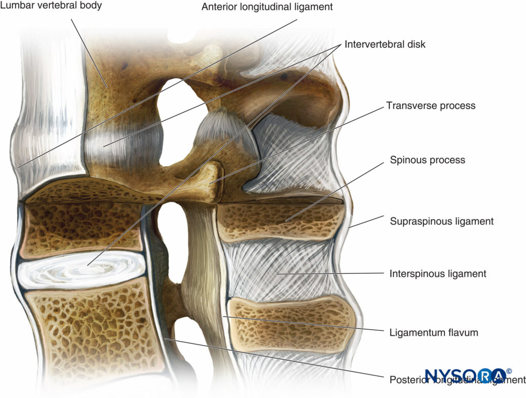 Epidural Anesthesia and Analgesia - NYSORA