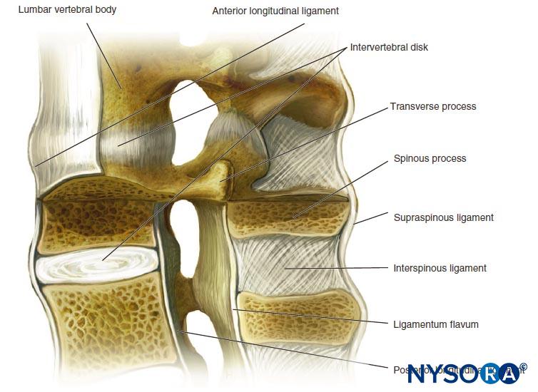 Epidural Anesthesia And Analgesia - Nysora