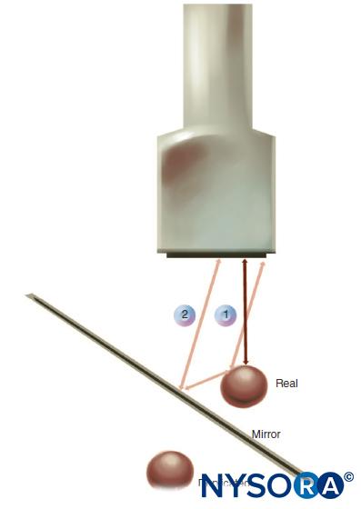 Physics of Ultrasound - NYSORA