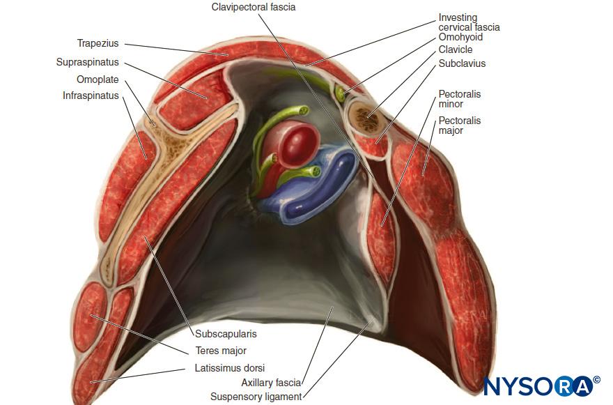 Pectoralis And Serratus Plane Blocks - NYSORA