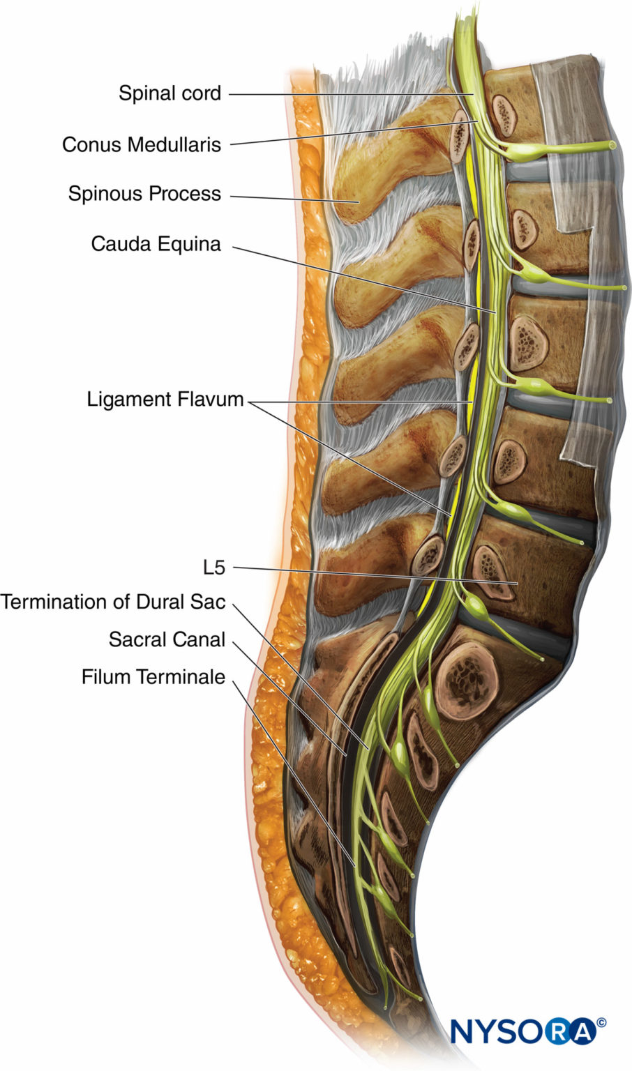 Spinal Anesthesia - NYSORA