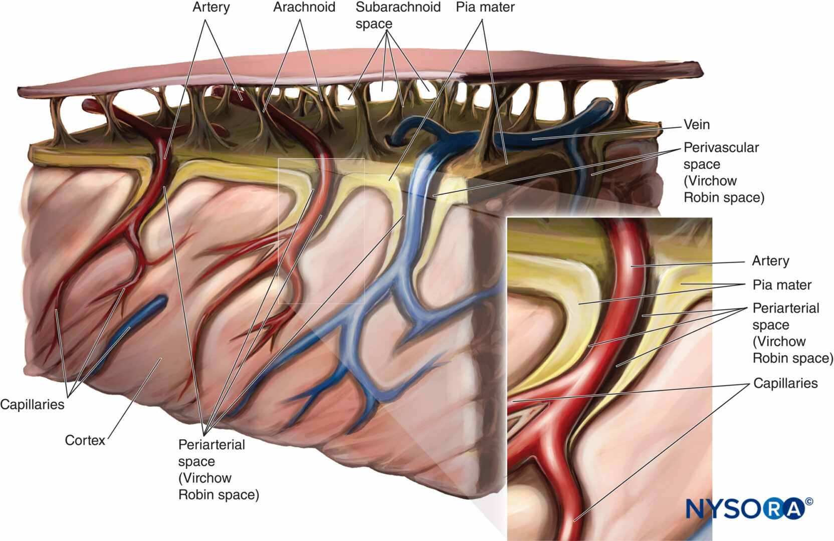 Конвекситальное пространство головного мозга. Пространства Вирхова-Робина. Virchow Robin Space. Периваскулярные пространства пространства Вирхова-Робина. Пространство Вирхова Робина анатомия.