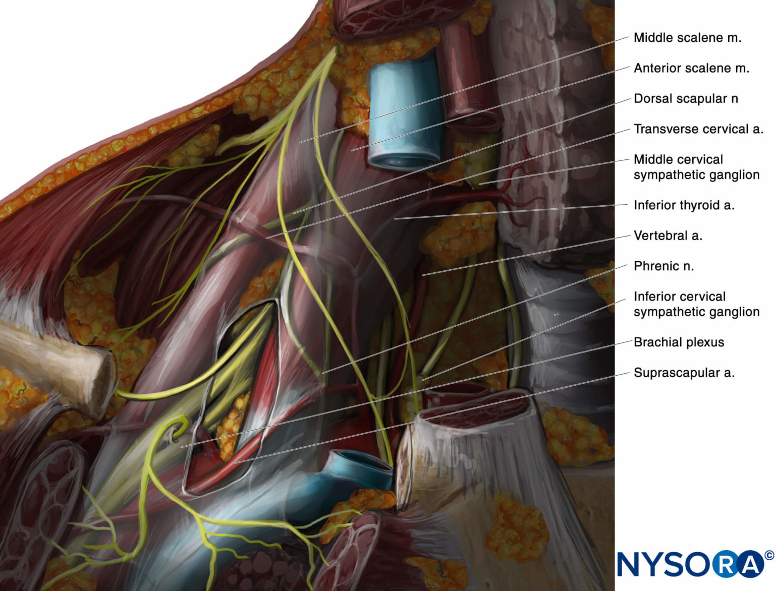 Bloc Nerveux Interscalénique Du Plexus Brachial Guidé Par Ultrasons Nysora 4423