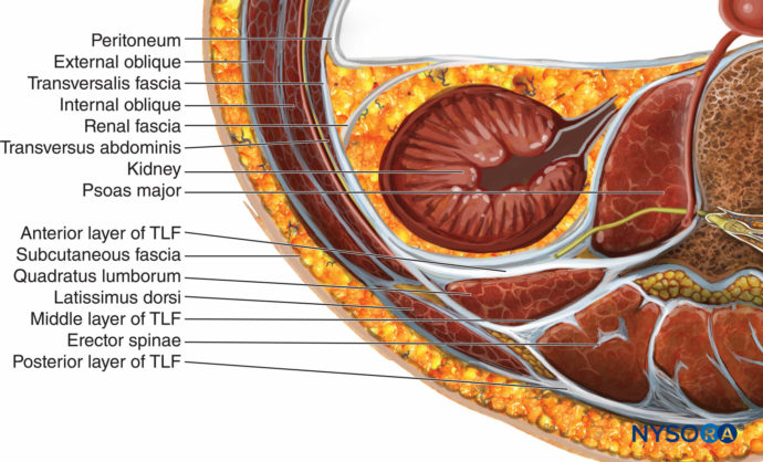 Ultrasound-Guided Transversus Abdominis Plane and Quadratus Lumborum ...