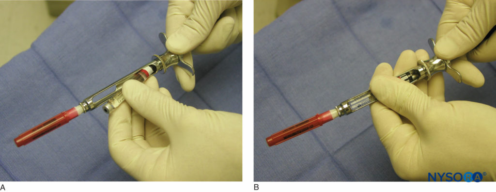 Oral & Maxillofacial Regional Anesthesia - NYSORA