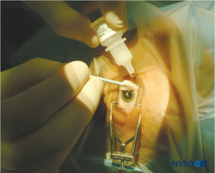 Regional Anesthesia Topical Anesthesia Nysora