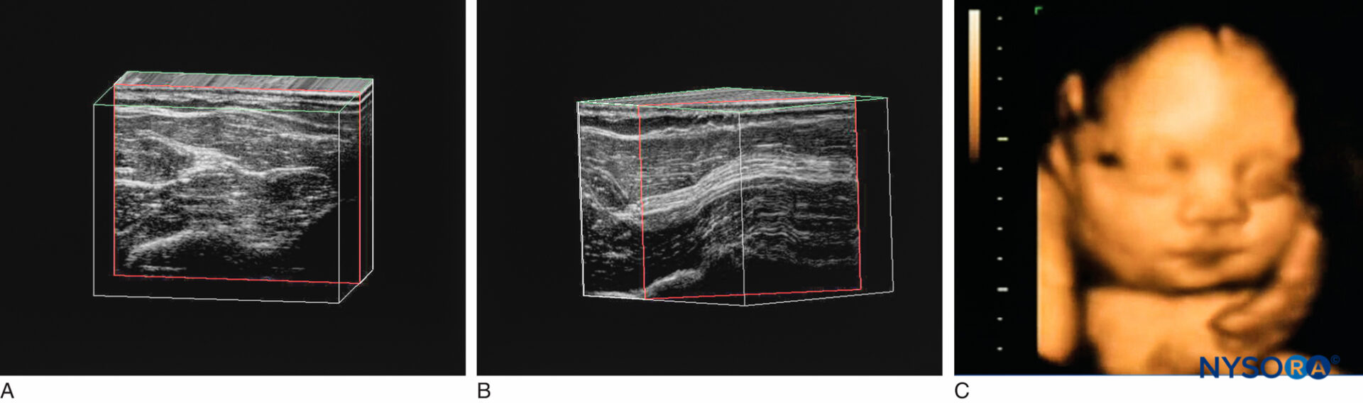 Échographie Cadre photo à ultrasons Cadre photo à ultrasons pour