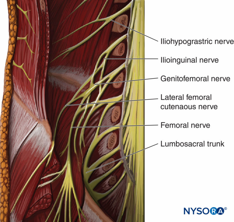 regional-anesthesia-psoas-muscle-exposed-from-within-the-abdominal ...