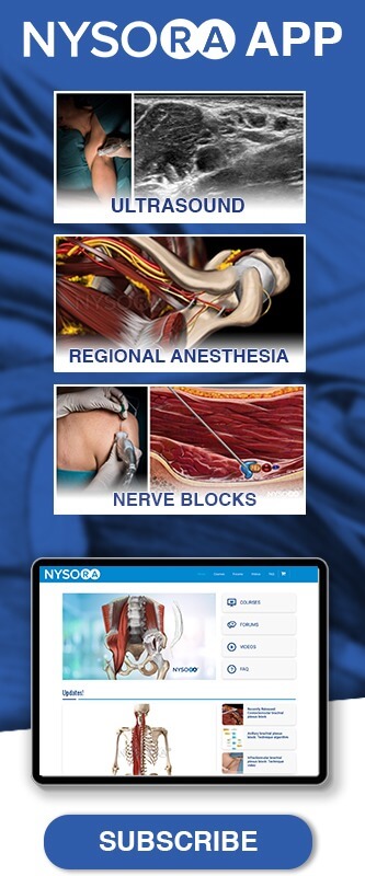 Interscalene And Supraclavicular Brachial Plexus Blocks