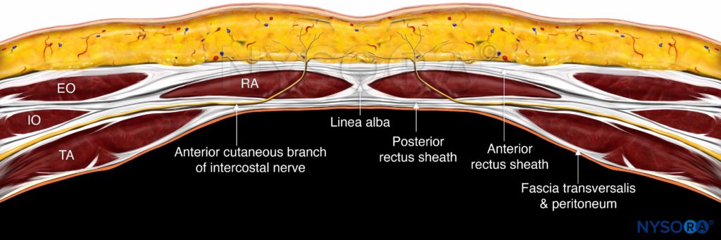 Rectus Sheath Block Anatomy