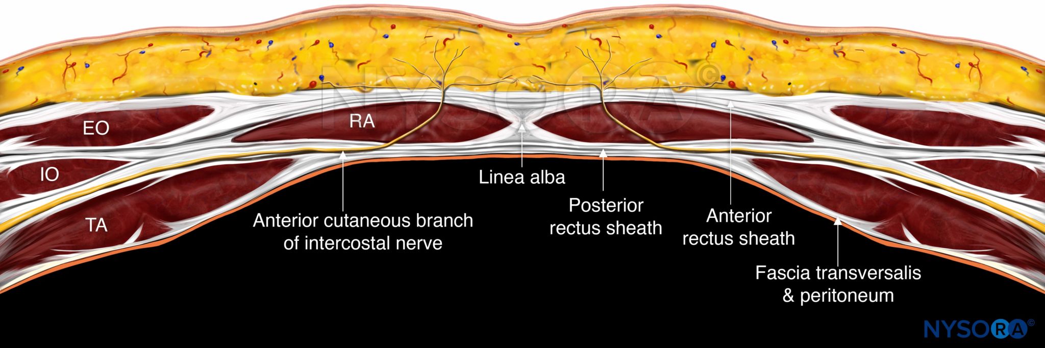 Trunk_Rectus_Cross-section1 - NYSORA