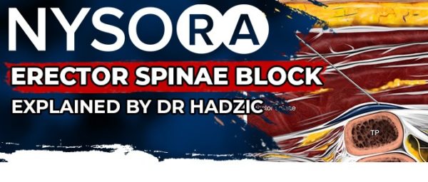 Erector Spinae Block (ESB) ERKLÄRT – NYSORA