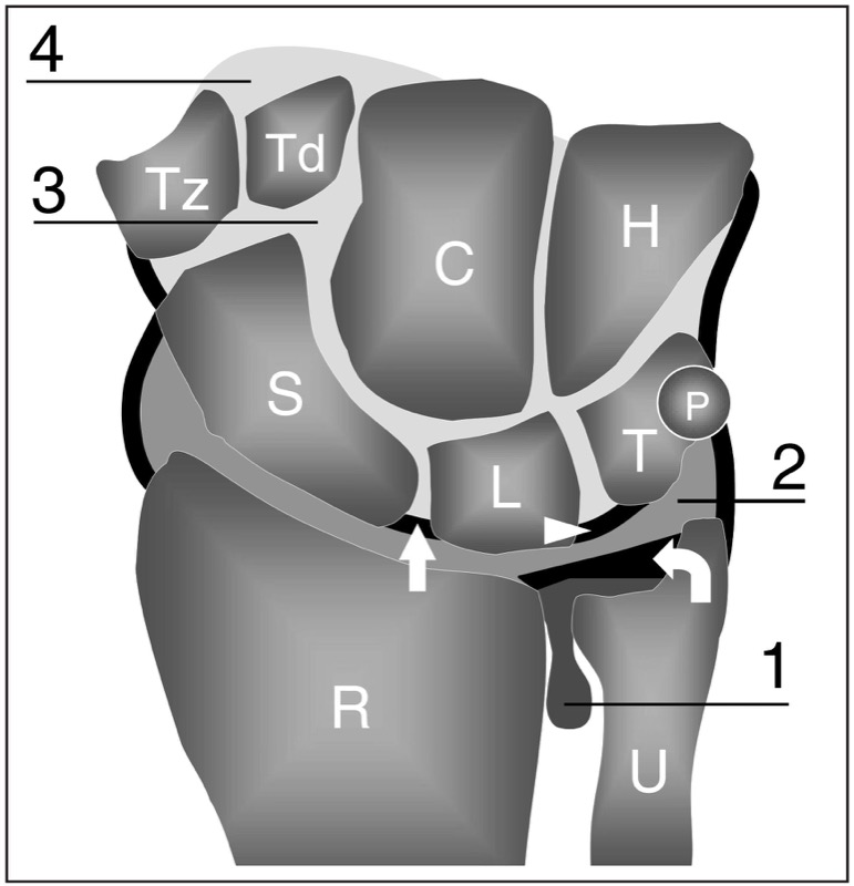 Anatomie de la main et du poignet - Articulations, os du carpe, tendons et  nerfs, Pathologie de la main