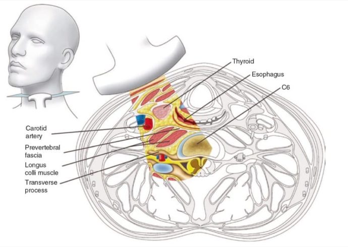 Ultrasound-Guided Cervical Sympathetic Block - NYSORA