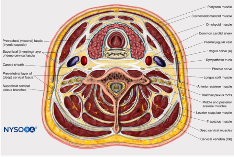 interscalene block - NYSORA