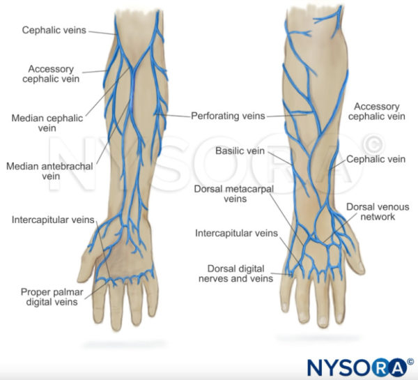 Difficult IV Access: Cephalic Vein - NYSORA