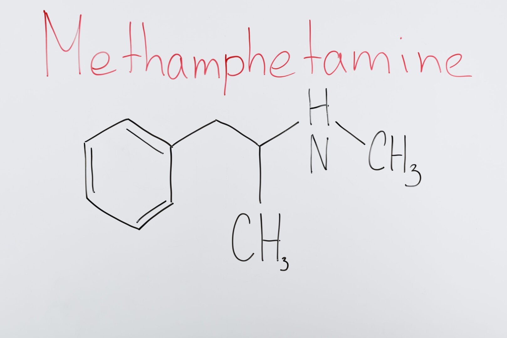 Methamphetamine toxicity