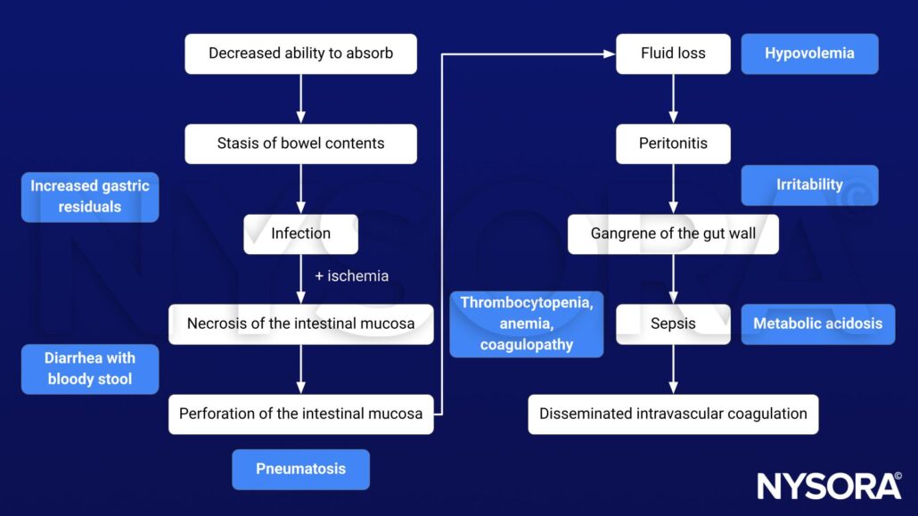 Necrotizing enterocolitis - NYSORA | NYSORA