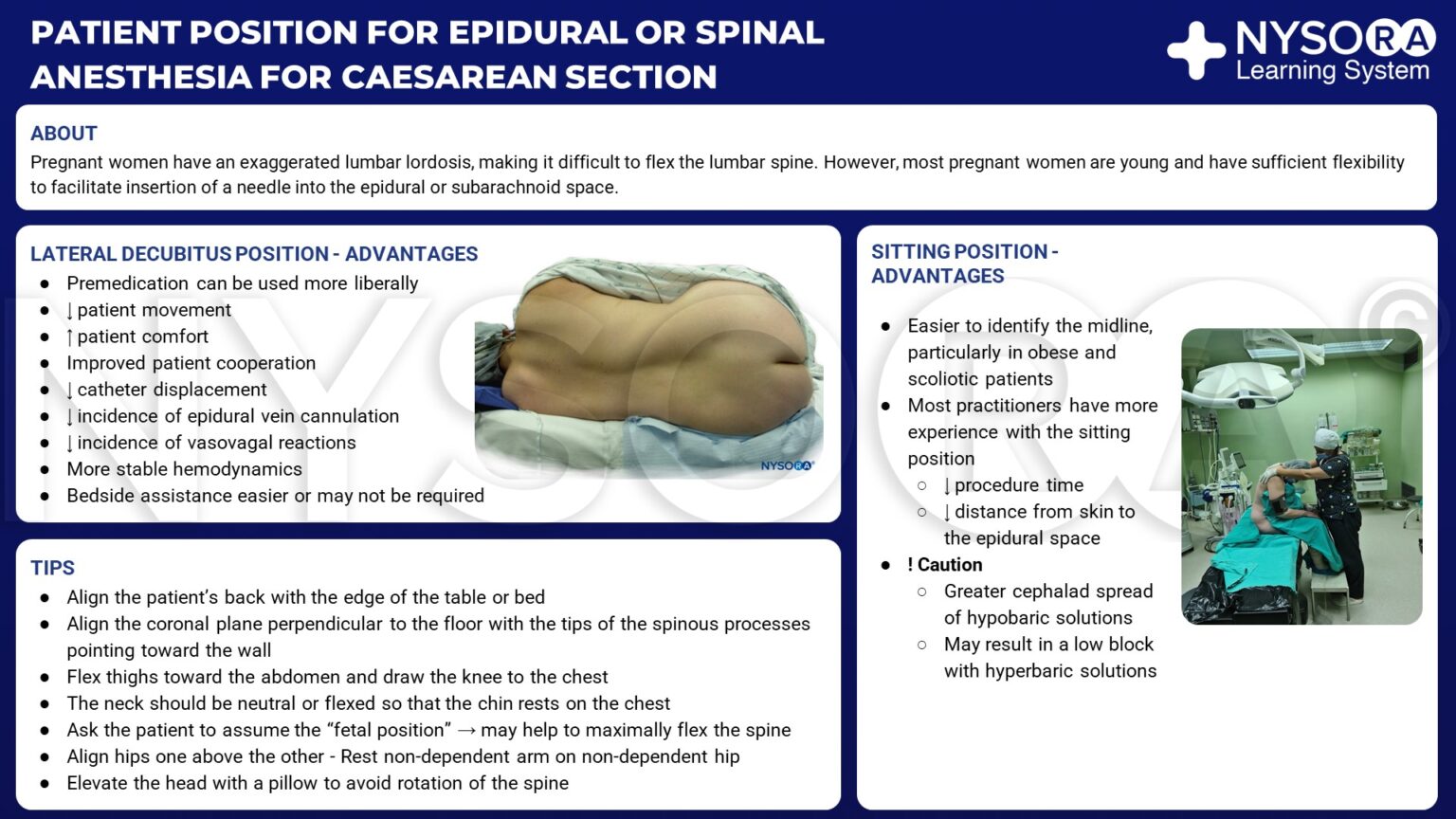 Patient Position For Epidural Or Spinal Anesthesia For Cesarean Section ...