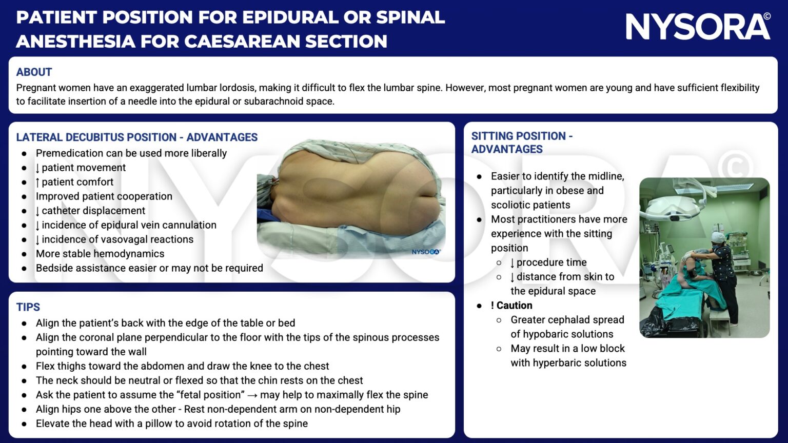 patient-position-for-epidural-or-spinal-anesthesia-for-cesarean-section