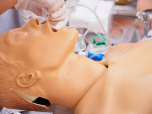 Blind nasal intubation