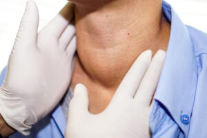 Thyroidectomy