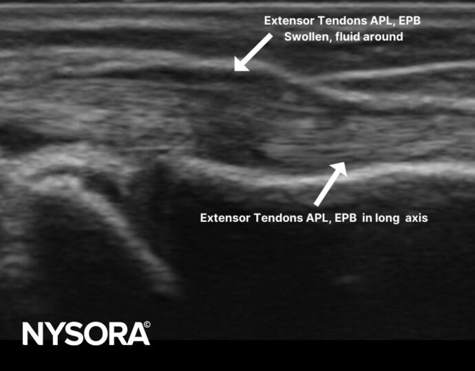 DQ diagnosis longitudinal - NYSORA