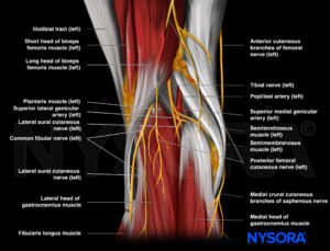 4.1 Baker's Cyst Neck Position Copy - Nysora 