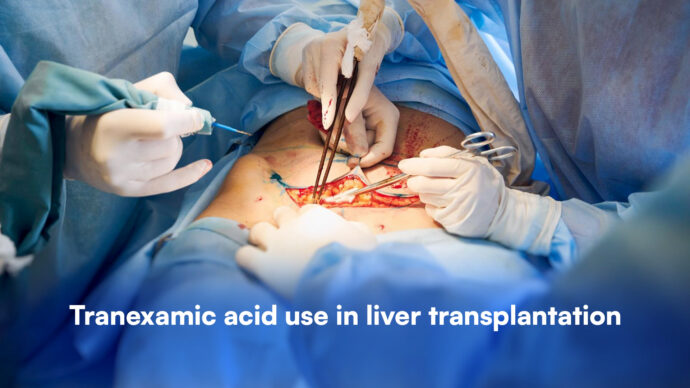 Tranexamic Acid Use in Liver Transplantation: No Significant Impact on Blood Loss or Red Blood Cell Transfusions