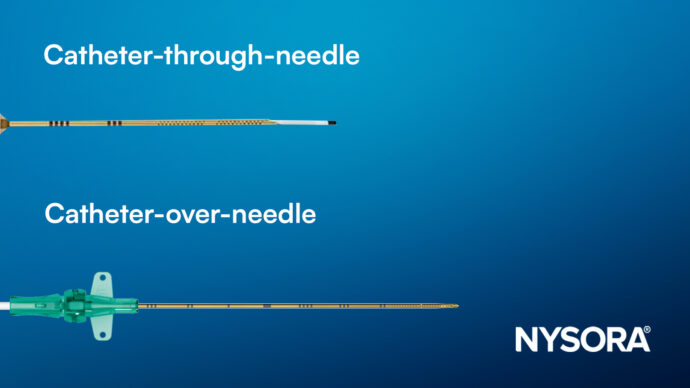 Understanding perineural catheter designs: Which one is right for your practice?