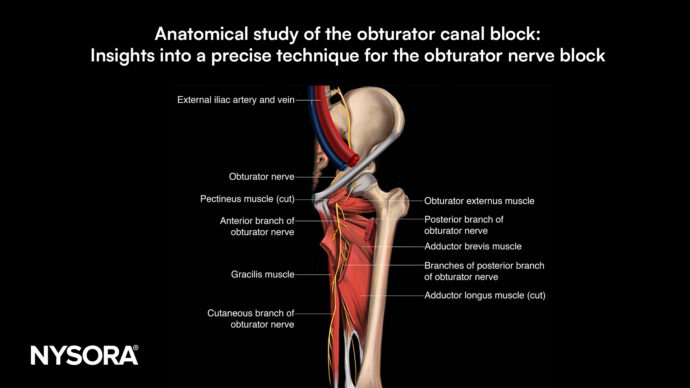 Anatomical study of the obturator canal block: Insights into a precise technique for the obturator nerve block