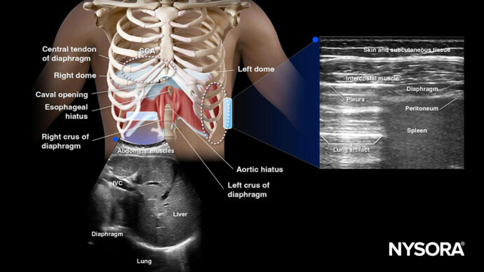 A novel point-of-care ultrasound method for assessing diaphragmatic excursion