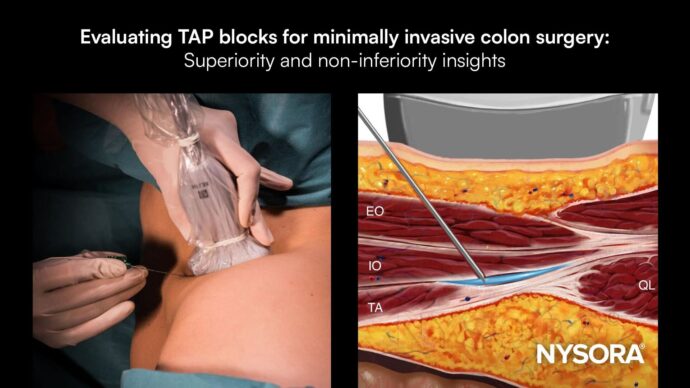 Evaluating TAP blocks for minimally invasive colon surgery: Superiority and non-inferiority insights