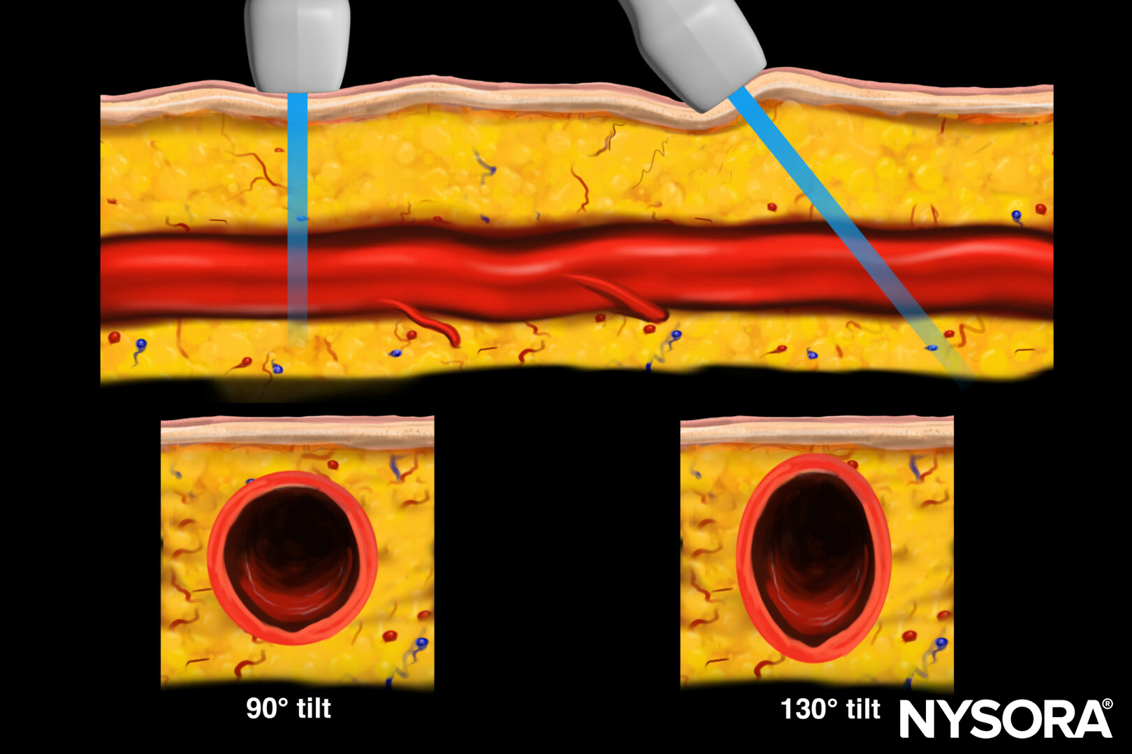 Essential ultrasound for vascular access
